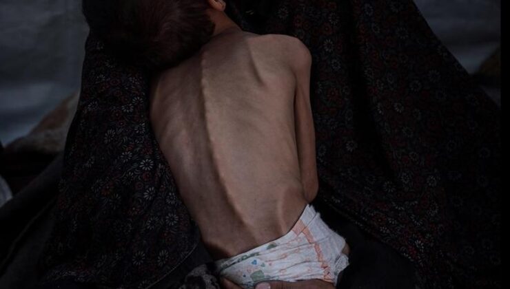 İsrail’in ablukası nedeniyle kıtlık yaşanan Gazze’de açlıktan ölenlerin sayısı 455’e yükseldi