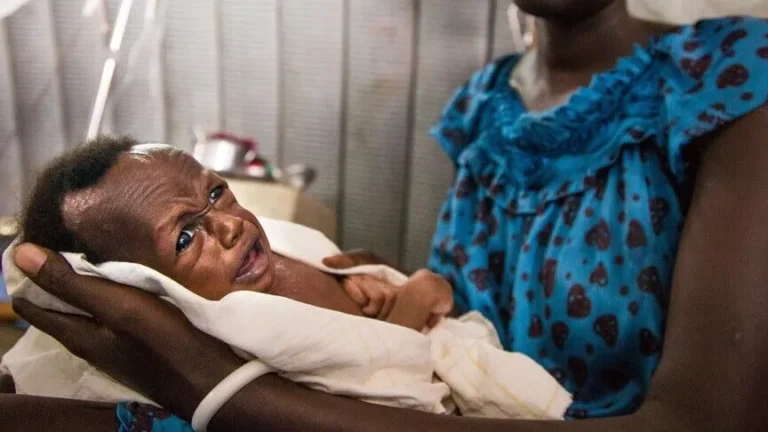 DSÖ: Sudan’da yetersiz beslenen çocuklar ölümcül hastalıklara karşı daha savunmasız
